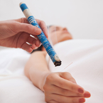 Moxibustion applied to the body.