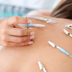 Electric stimulation of acupuncture points for increased Qi circulation and pain relief.